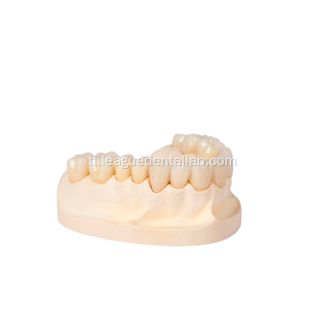Buong Medikal na Dental Zirconia Crown